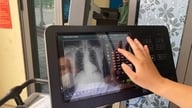 Hanoi menawarkan pemeriksaan gratis untuk 12 penyakit kronis dan ganas.